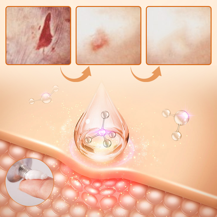 Ceoerty® Diabetes Wound Strong Treatment Cream