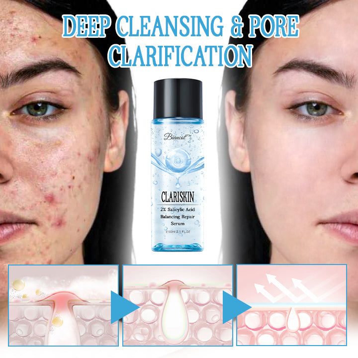 Biancat™ ClariSkin 2% Salicylic Acid Balancing Repair Serum