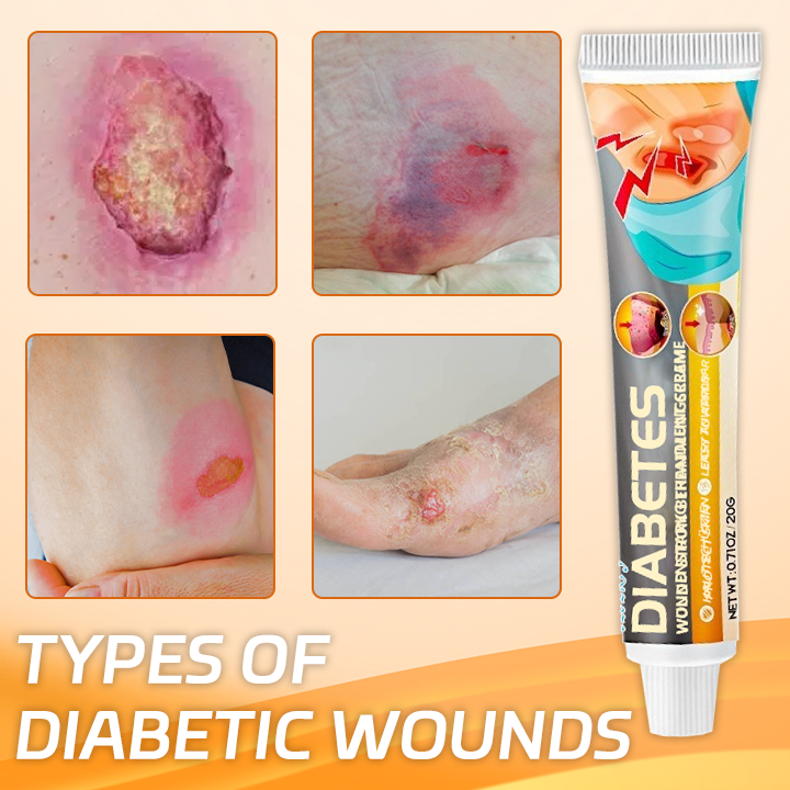 Ceoerty® Diabetes Wound Strong Treatment Cream