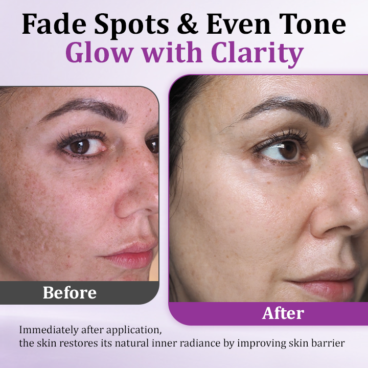 Ceoerty® MelantraX Advanced Anti-Hyperpigmentation Essence⭐