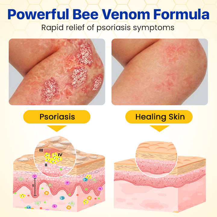 Biancat™ DermalBee Bee Venom Skin Repair Mist⭐