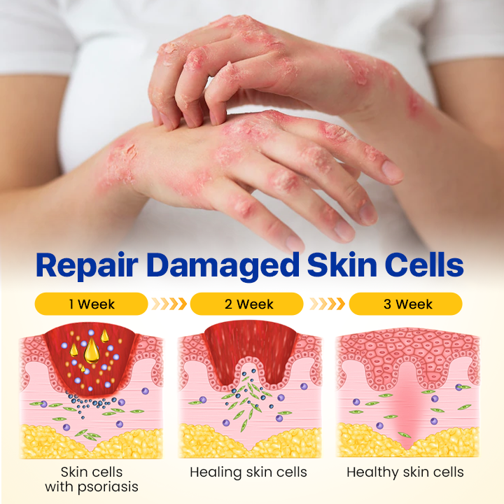 Biancat™ DermalBee Bee Venom Skin Repair Mist⭐