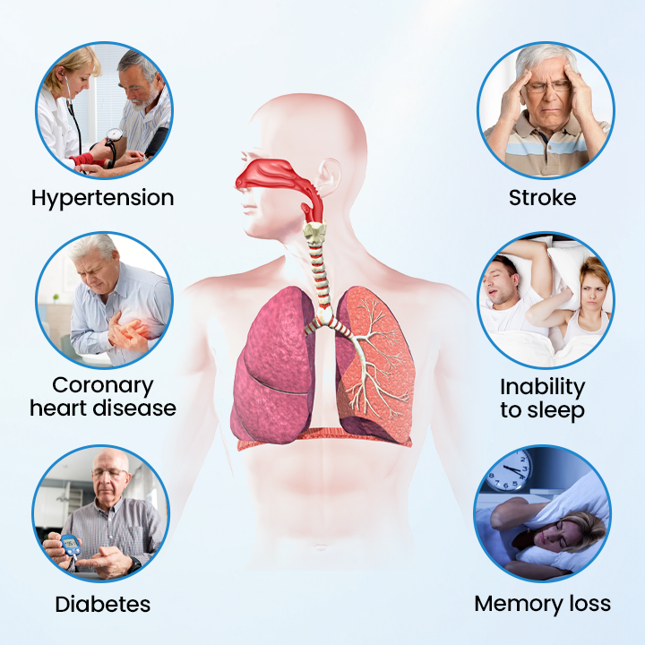 Timilk® SnoreLess Nasal Breather