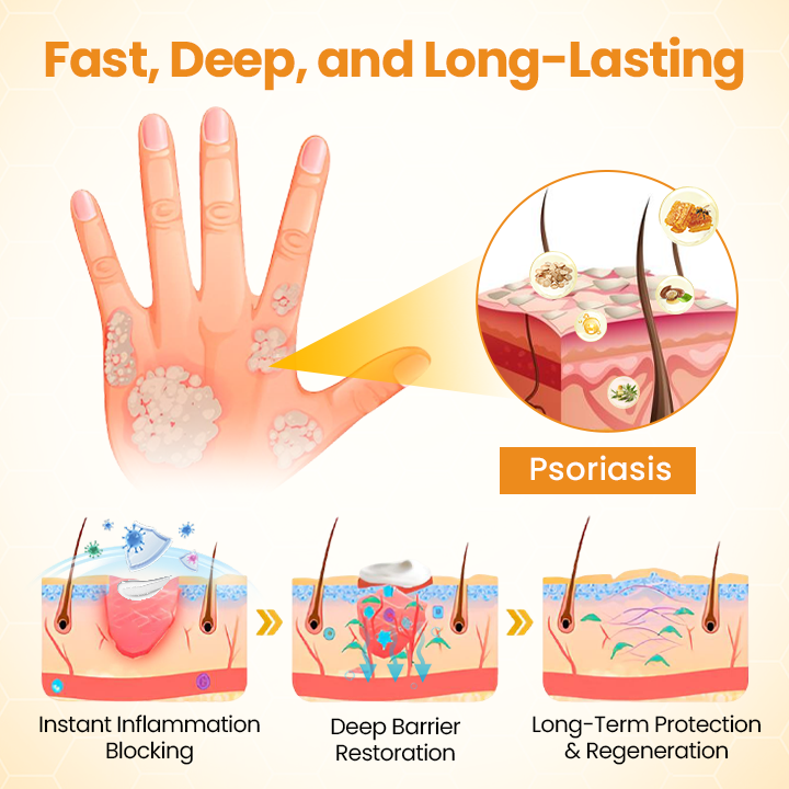 Timilk® BeeLieve Psoriasis Skin Care