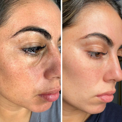 Biancat® LiftRenew All-in-One Under-Eye Stick