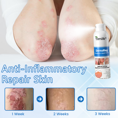 ✅ Official Store: Timilk® DermaMag Magnesium Repair Spray 🔥 FDA Certified (Clinically Proven Relief for Psoriasis, Eczema, and Chronic Skin Irritation 🌿)