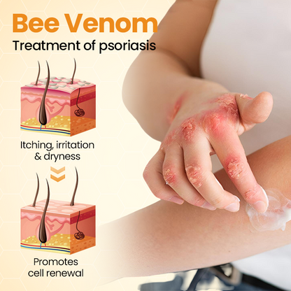 Timilk® BeeLieve Psoriasis Skin Care⭐