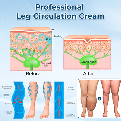 ✅ Official Store: Timilk® LymphoEase Magnesium PCA Roll-On Relief Cream 🔥 FDA Certified (Clinically Proven Relief for Lymphedema, Leg Swelling & Poor Circulation 🩺)