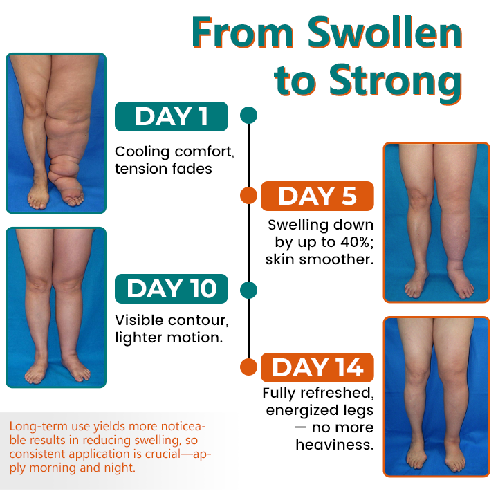 Timilk® LymphoEase Magnesium Roll-On Relief Cream