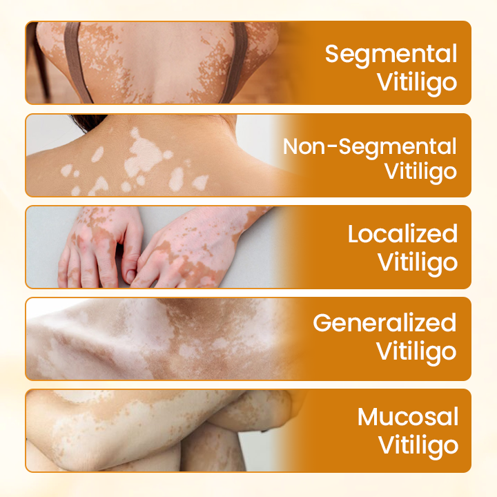 Timilk® VitiCalm Bee Venom Cream