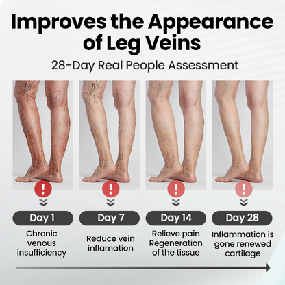 Czticle® Leg Vein Magnet Ankle Bracelet