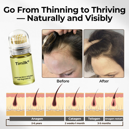 Timilk® HairFuse Micro-Infusion Hair Regrowth Kit