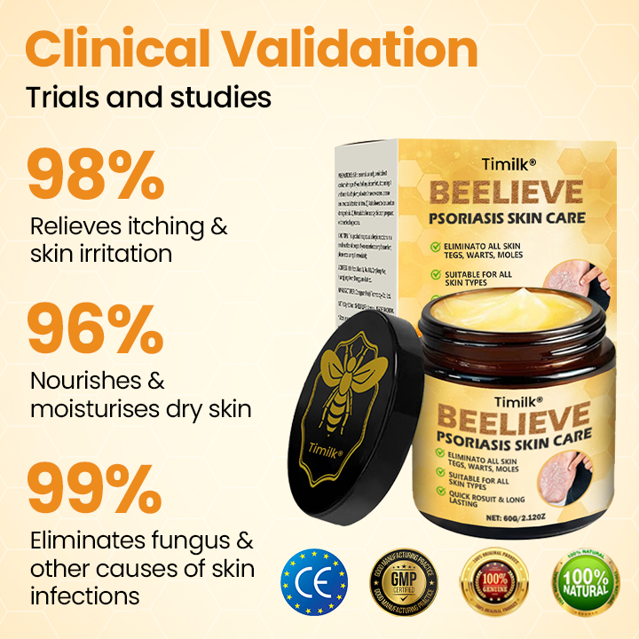 Timilk® BeeLieve Psoriasis Skin Care⭐