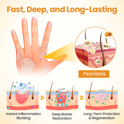 Timilk® BeeLieve Psoriasis Skin Care